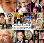Exploring the Black Eye Club: What It Is and Its Significance