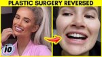 Haley Layne Plastic Surgery Before: Unveiling the Truth