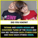 Krista and Tatiana Hogan 2024: the Remarkable Journey of the Twin Sisters