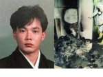 Photos: Hisashi Ouchi - the Corpse Man Who Survived Nuclear Radiation